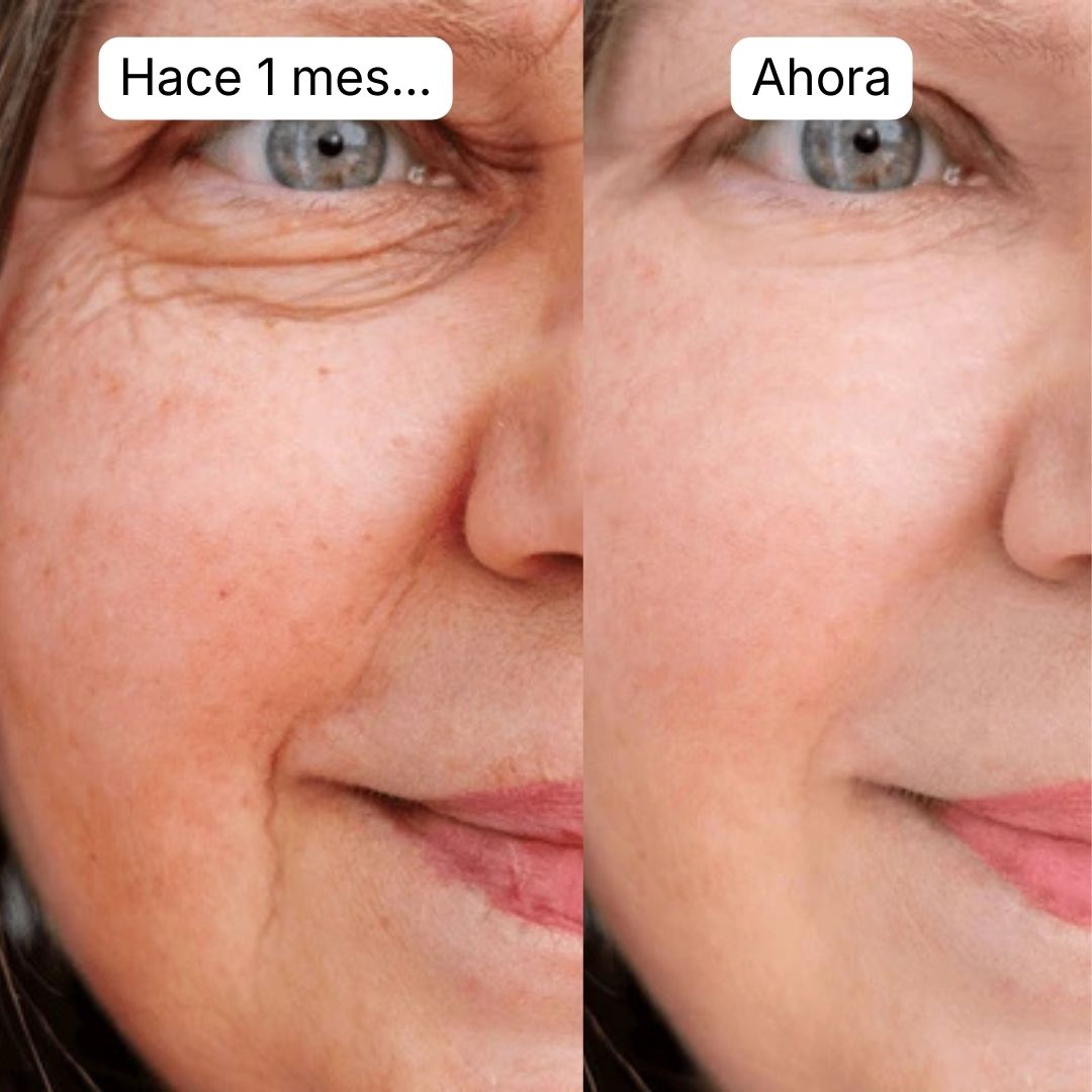 files/ANTES_Y_DESPUES_LANDING_3.jpg