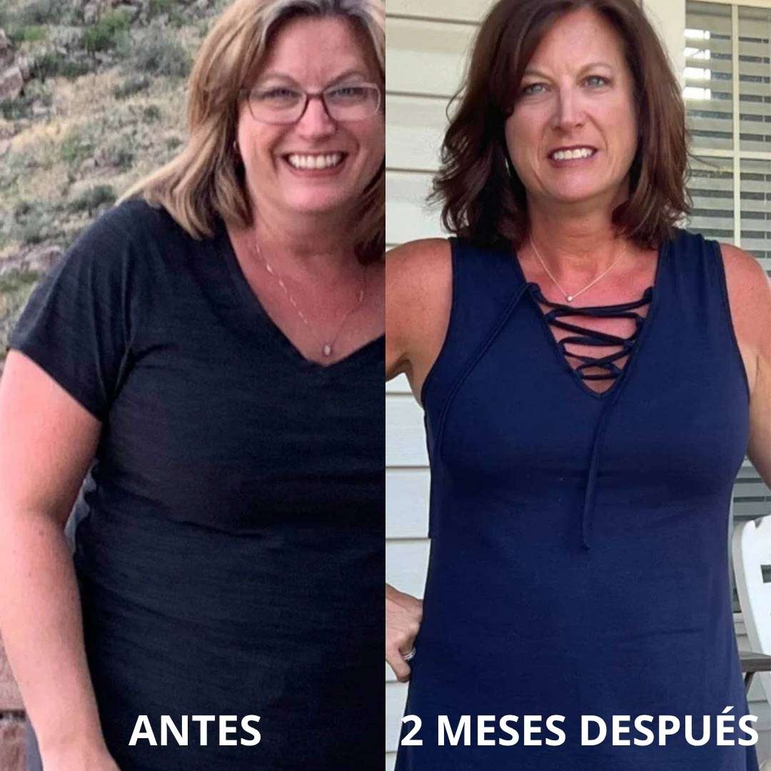Para Mujeres que ya lo Han Probado Todo | Parches Adelgazantes Velvet™