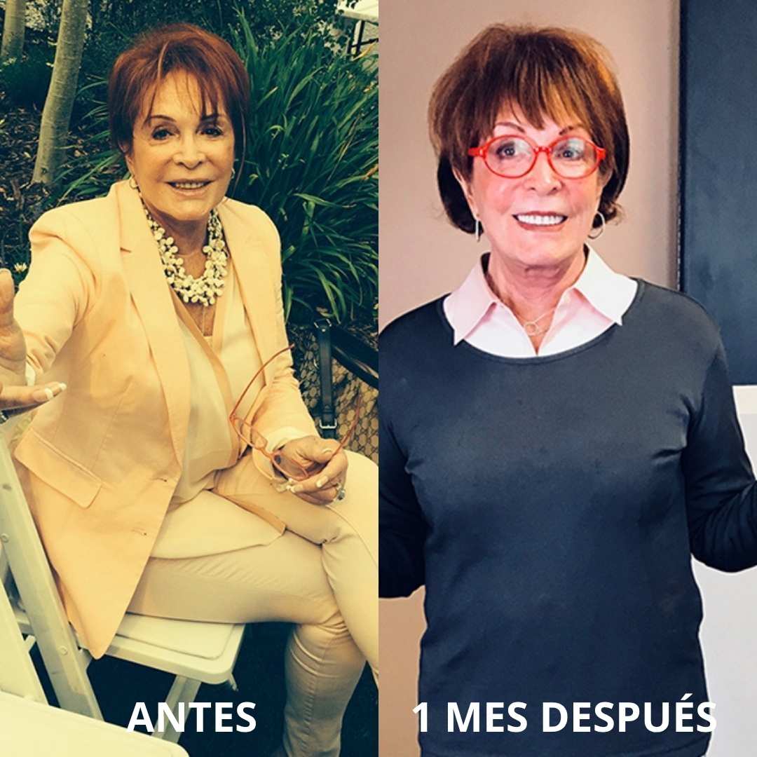 Para Mujeres que ya lo Han Probado Todo | Parches Adelgazantes Velvet™