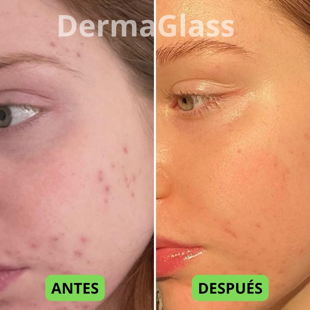 Recupera el Brillo de Tu Piel | DermaGlass by Velvet™