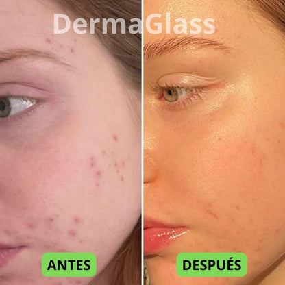 Recupera el Brillo de Tu Piel | DermaGlass by Velvet™