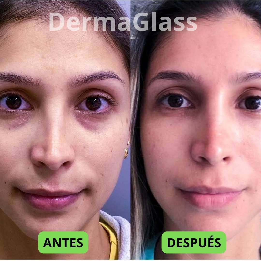 Recupera el Brillo de Tu Piel | DermaGlass by Velvet™