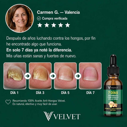 Aceite anti-hongos uñas